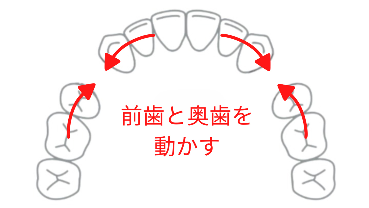 出っ歯や口ゴボがひどくなることも- 熊本市矯正歯科相談室