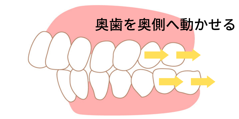 他院で断られた方もお任せ- 熊本市矯正歯科相談室