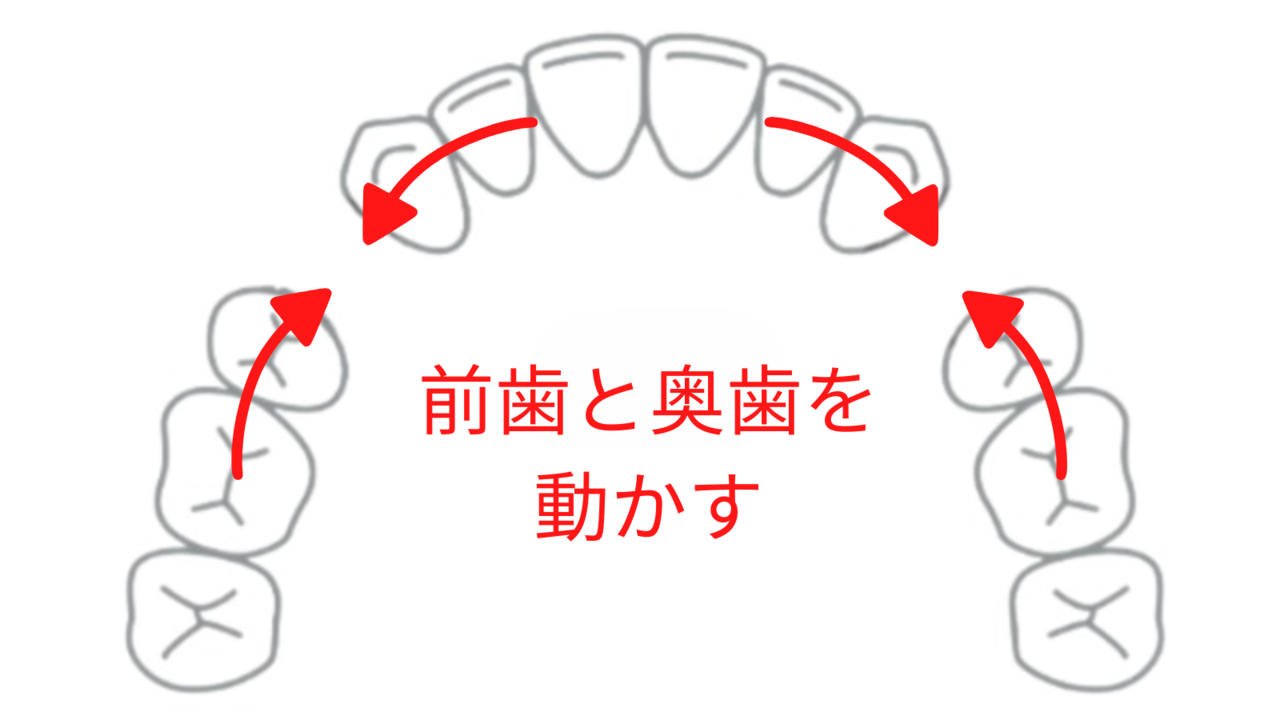 出っ歯や口ゴボがひどくなることも- 熊本市矯正歯科相談室