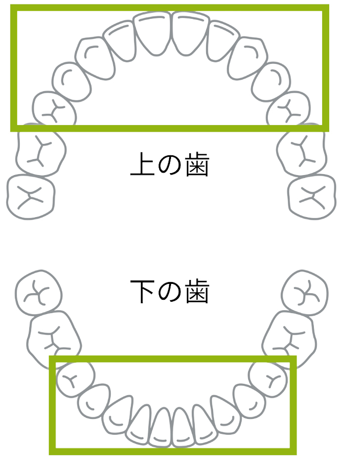 矯正の失敗例 - 熊本市矯正歯科相談室