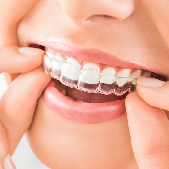 歯列矯正（歯の矯正）の名医 - 熊本市矯正歯科相談室