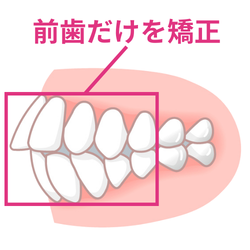 他院で断られた方もお任せ- 熊本市矯正歯科相談室